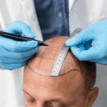 Thyroid Health: How Specialised Doctors Help with Diagnosis and Treatment?